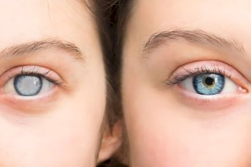 Watany Eye Hospitals
